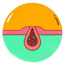 阴道边上长了个痘痘不痛也不痒