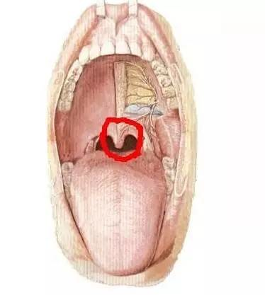 悬雍垂过长是什么原因图片