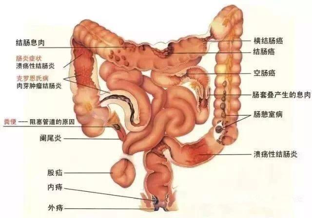 肠胃分布图片高清图片