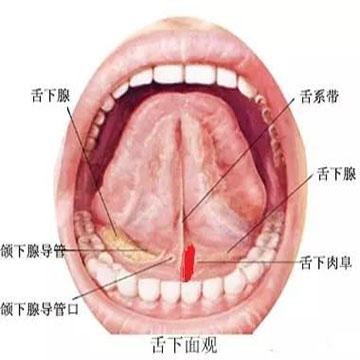 舌下腺袋形缝合术图解图片