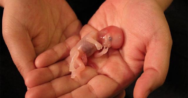 6个月堕胎图片
