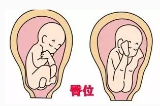 胎儿入盆打嗝位置图解图片