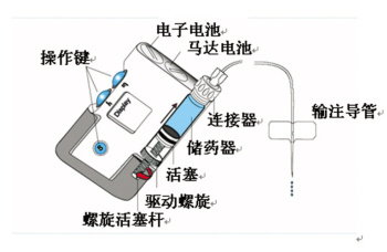 胰岛素泵原理图图片