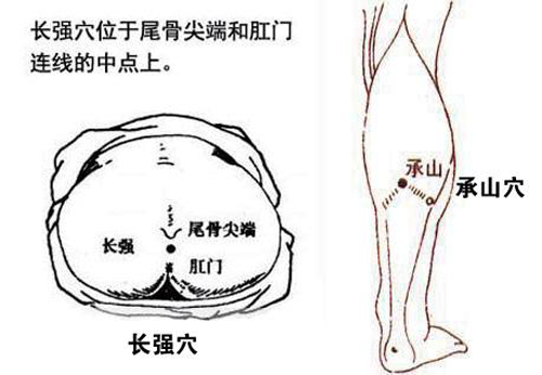 揭秘:艾灸能治痔疮吗?