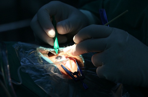 湘潭市第一人民医院成功开展首例玻璃体切割术
