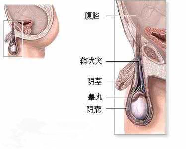 宝宝下身胀大是腹股沟疝还是鞘膜积液?