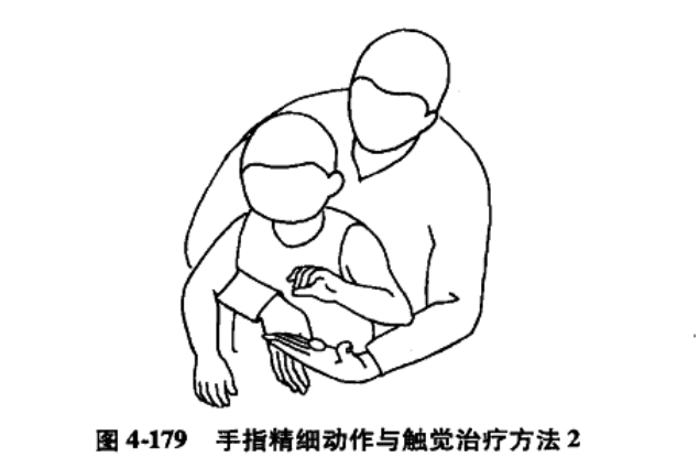 肌張力低下型腦癱患兒的作業治療方法(舉例彙總)