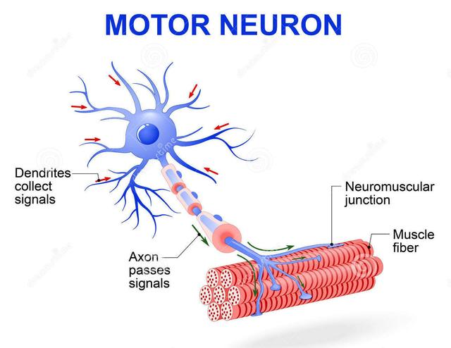 运动神经元病发病的几种发病原因