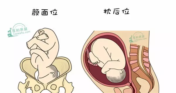 胎儿面朝妈妈的脊椎,后背靠着妈妈的肚皮,两手交叉于胸前,盘腿,头俯曲