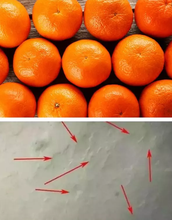 橘皮效应图片