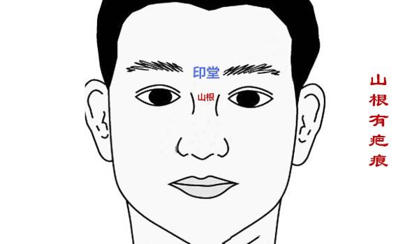 這四個部位有疤痕,影響配偶健康,易招口舌易破財