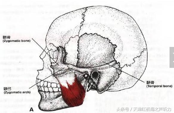 咬肌是最強有力的提升下頜骨和咀嚼肌,無論是在咬合和咀嚼時,咬肌均能