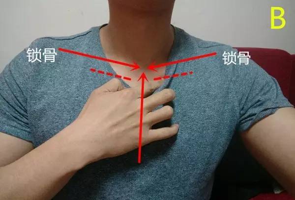 胸骨角在哪个位置图片图片