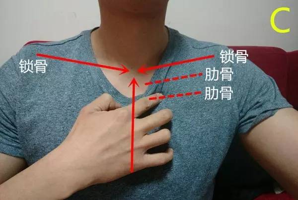 胸锁骨关节疼痛图片