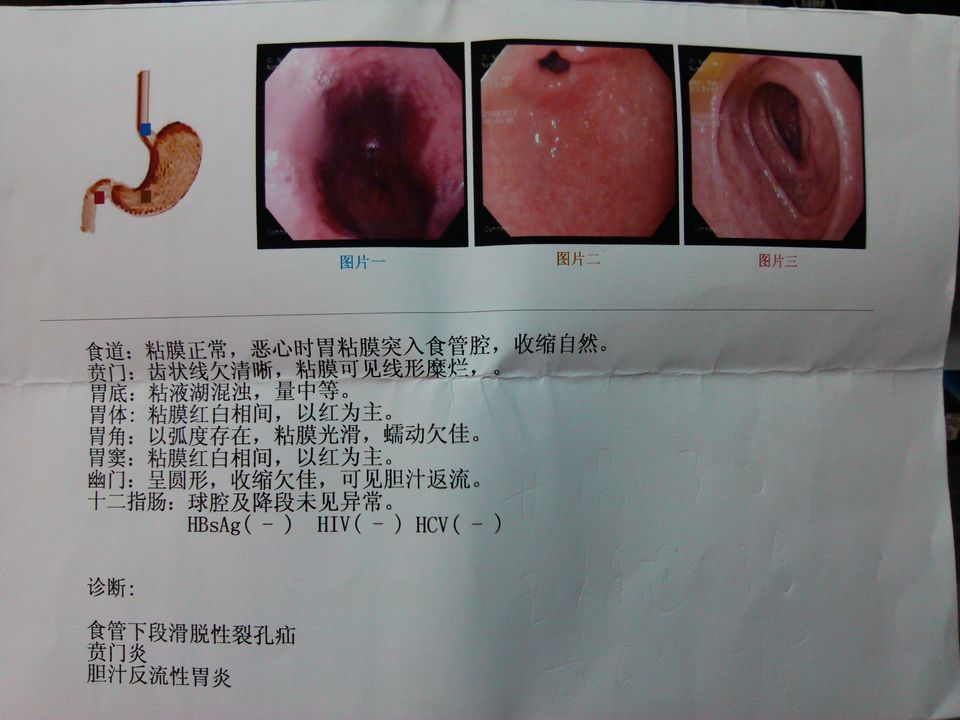 慢性胃炎诊断书p图图片
