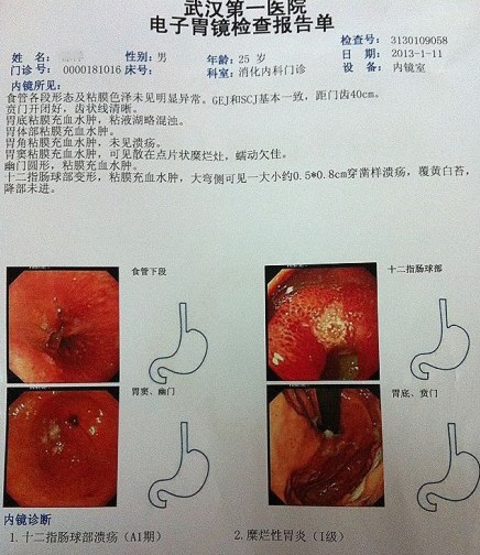 胃出血证明图片图片