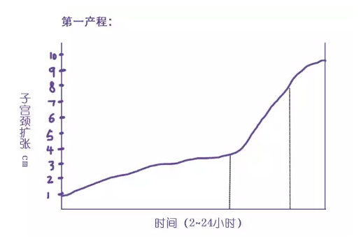 临产前的宫缩曲线图图片