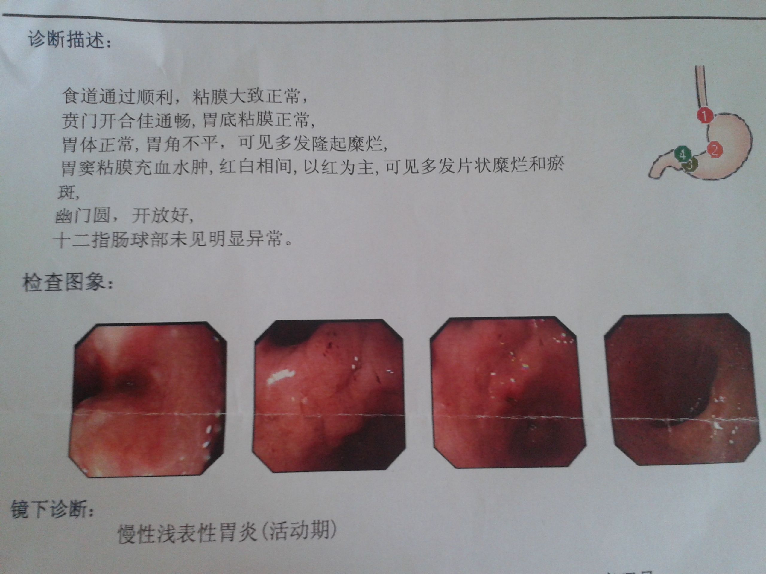 我曾为它感到无助,忧愁