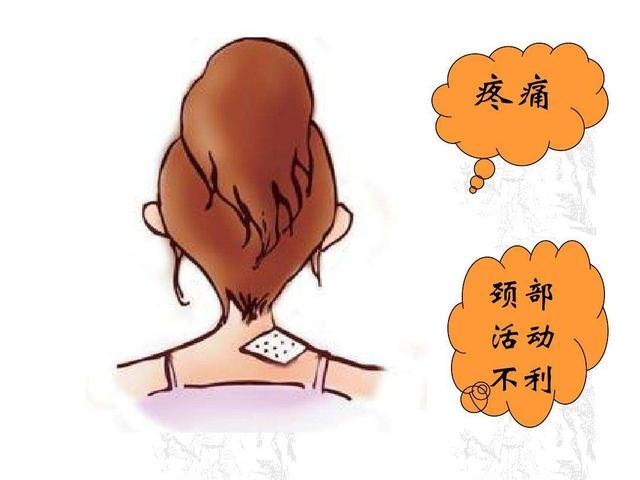 徐州│落枕是什么原因造成的?有什么办法解决吗