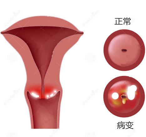 健康的宫颈照片 内部图片