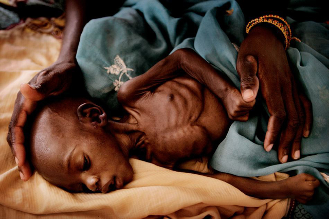 非洲儿童饥荒图片