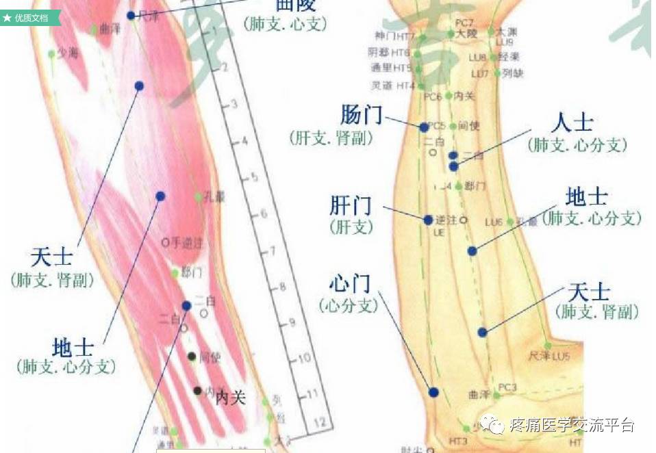 心门的准确位置图片图片