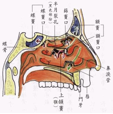 蝶窦图解图片