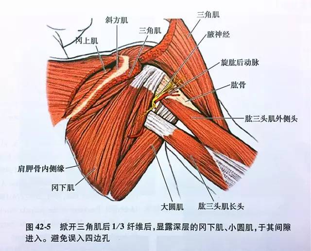 實例講解肩胛頸骨折如何內固定治療少見不可不會