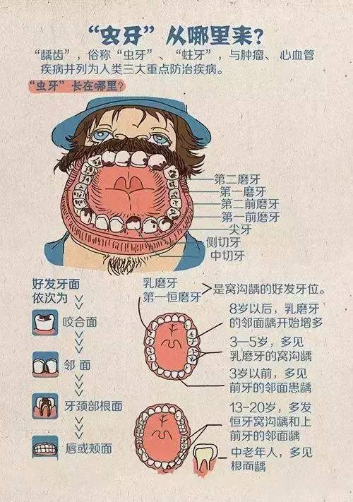 口腔图解"虫牙"从哪里来?