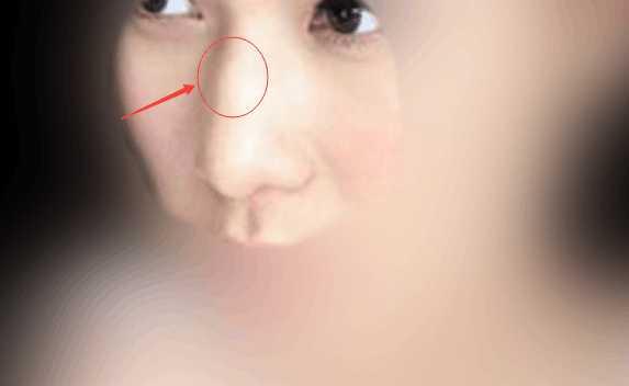 女人鼻梁有节图片图片