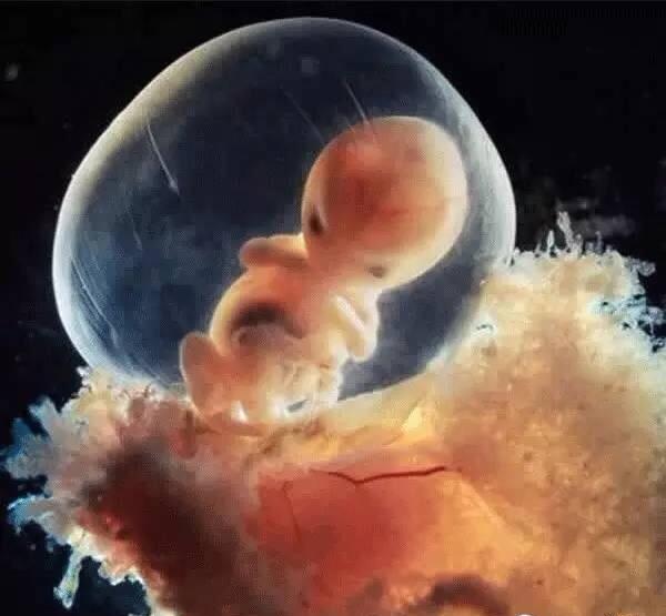 多年来,一组一直成为反堕胎活动且令人震撼的重要宣传照片