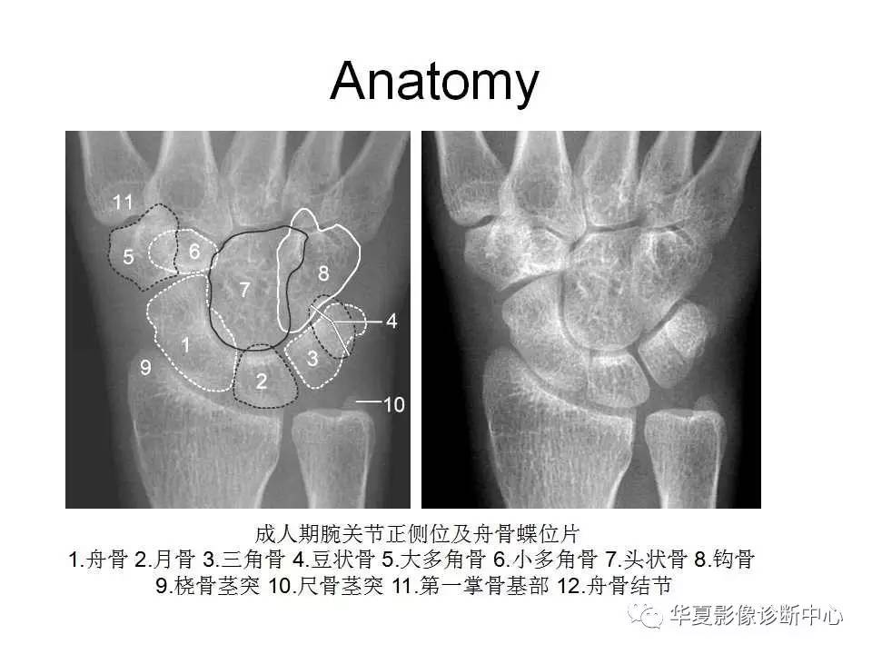 影像基础腕关节不简单