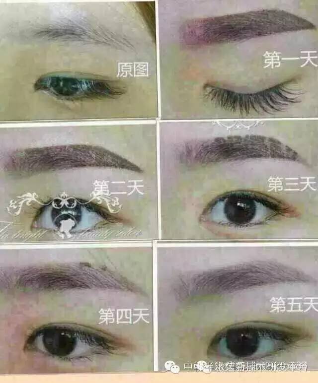 眉毛恢复过程图片图片