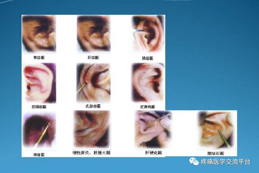 新中醫望診特色診療暨新四診(手診面診眼診耳診)精修班為進一步推廣新