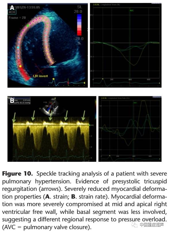 diagnosis;echocardiography; new technologies; prognosis