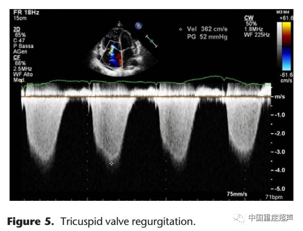 pmid:25244441differential diagnosis;echocardiography; new