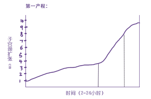 分娩配上宫缩,那是极好的事情!kama老师带你正确认识宫缩