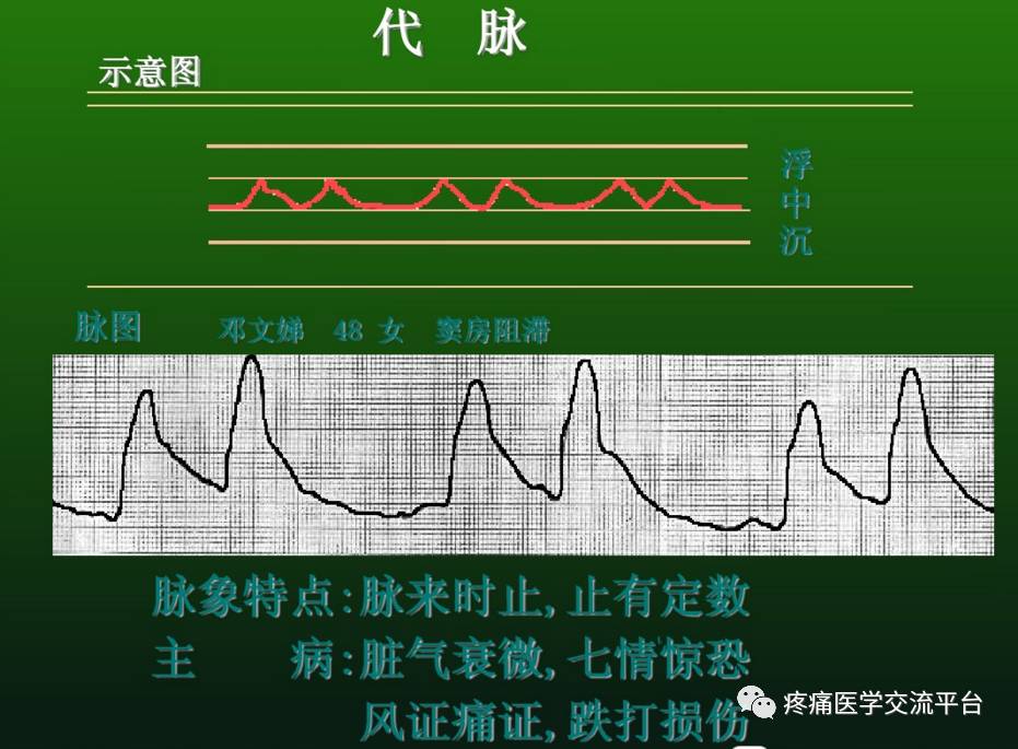 脉诊值得收藏