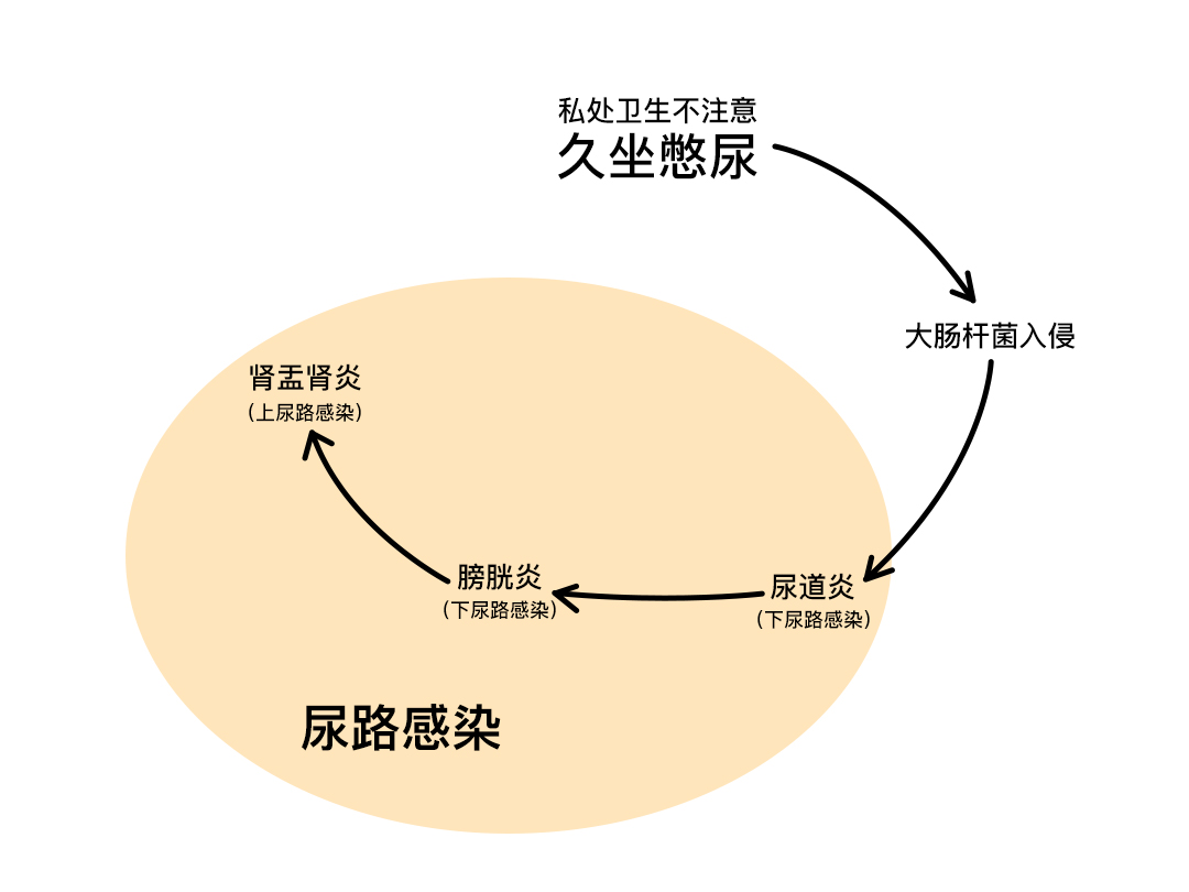 believe井:作为女人,你不能不知道的健康隐患:尿路感染