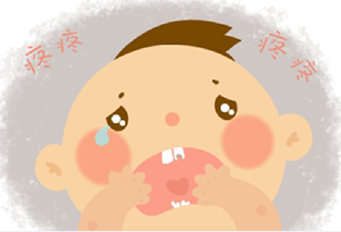 新生婴儿口腔溃疡图片