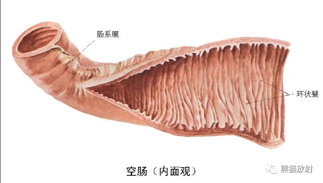 直肠横襞图片