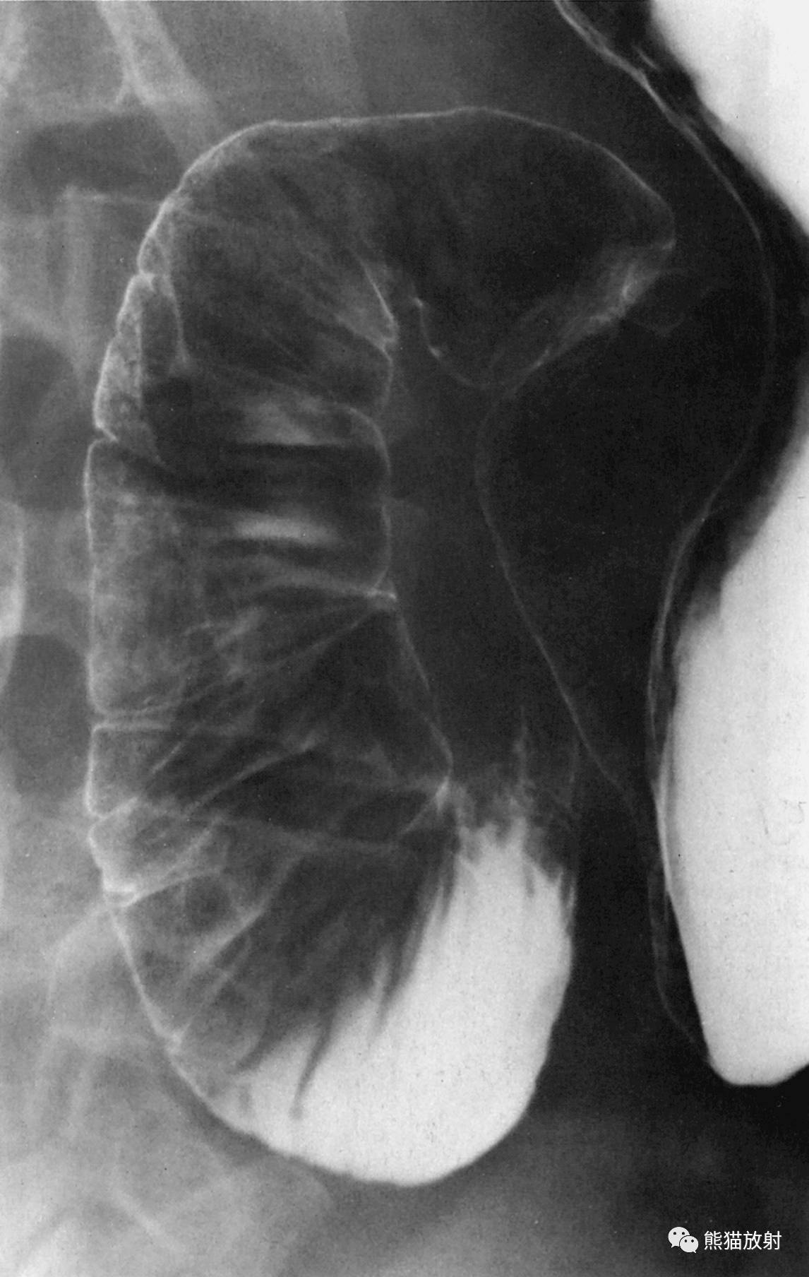 stomach and duodenum 胃和十二指肠