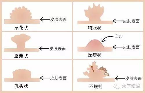 医生自己不慎感染 HIV ，是何种痛苦体验？