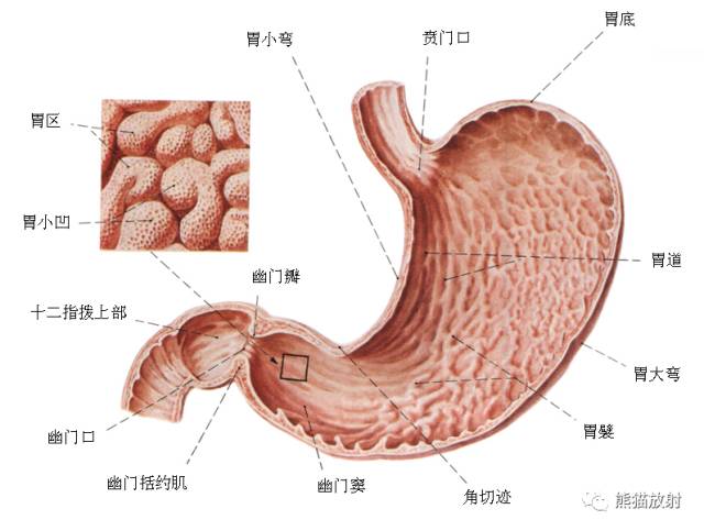 胃角前壁图片