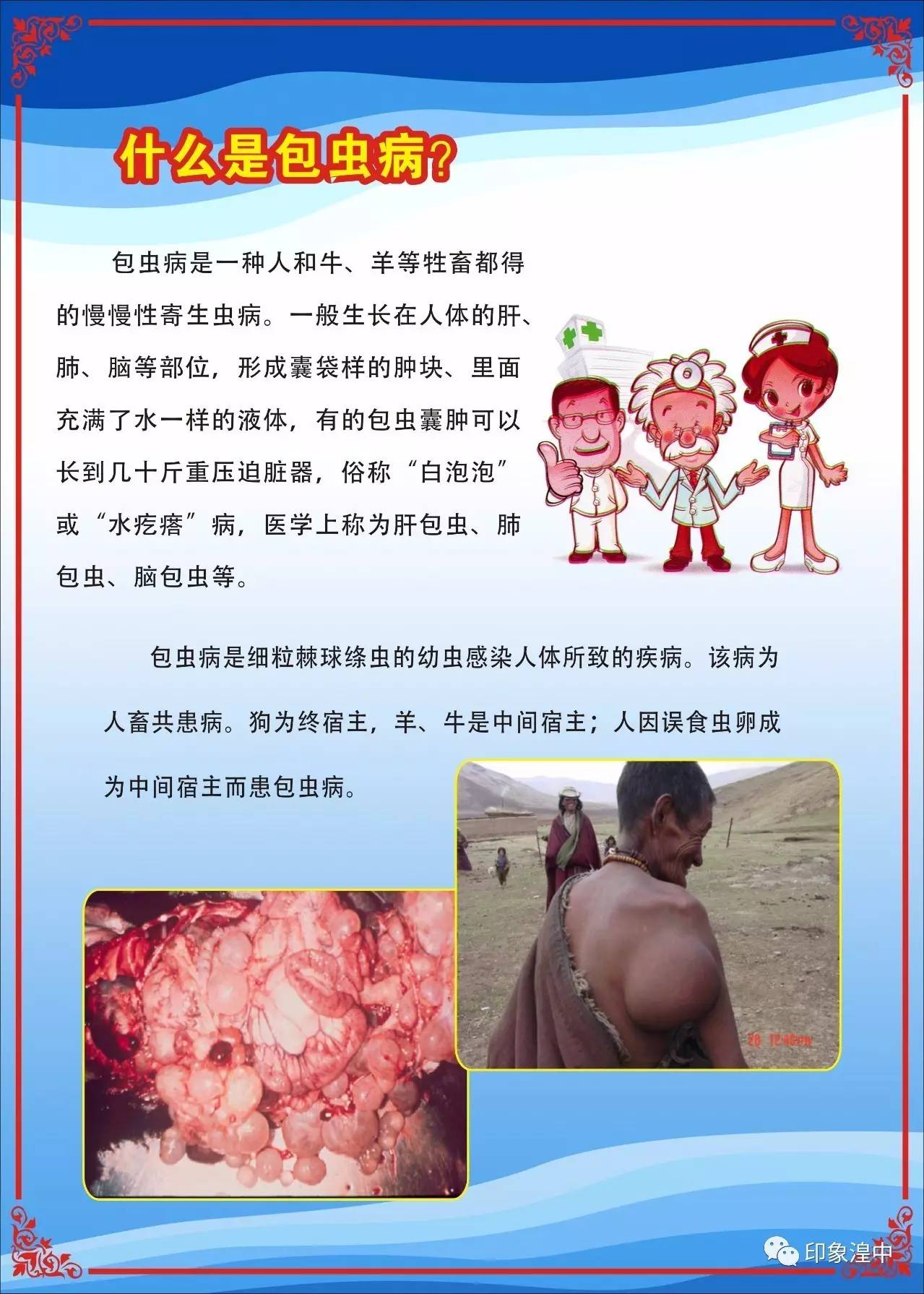 包虫病是什么症状图片图片