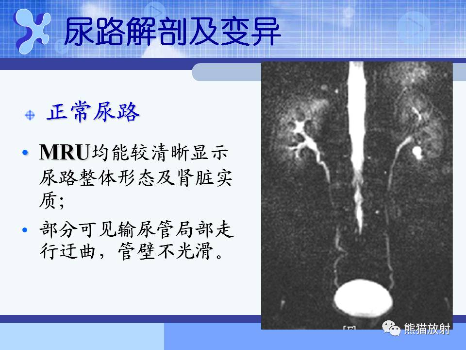 专题磁共振泌尿系水成像mru技术及临床应用