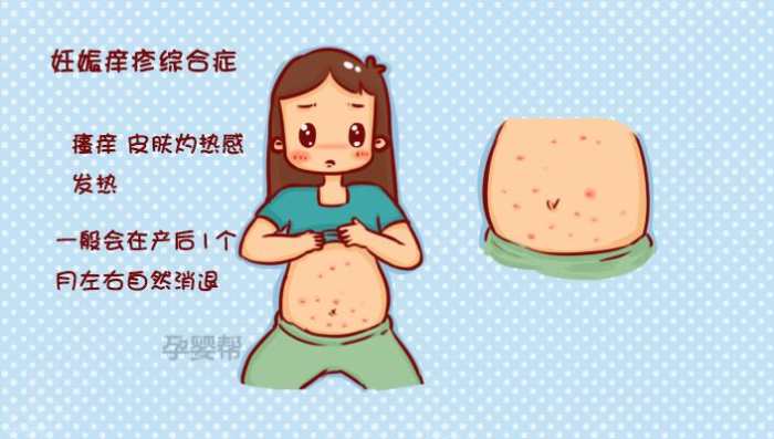 孕妇胆汁淤积的症状图图片