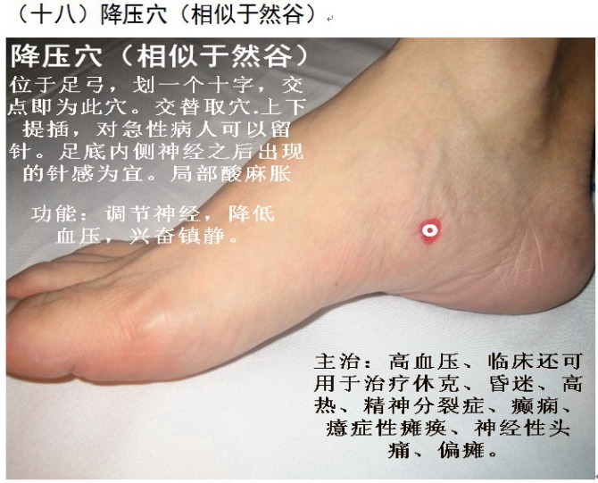 平衡针38个图解模型图片