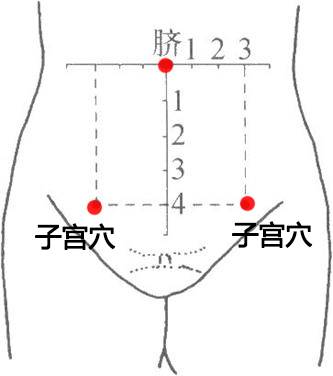 子宫穴位于下腹部,脐下一横掌处(脐下4寸)正中