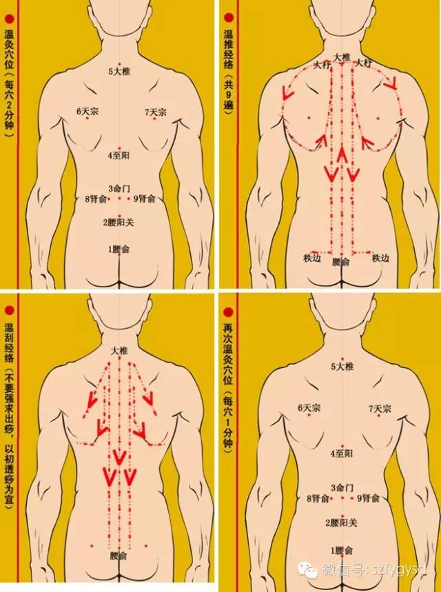 人体左后背疼痛部位图图片